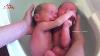 Adorable Twins Don T Realise Their Birth Cutest Video Ever Twin Baby Bath